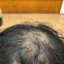 충청남도에서 토탈탈모교정성형펌 하러왔습니다… 제 머리도 될까요? [Part1] 주례감전사상하단김해모라구덕만덕전포양정부전부암수영양정망미 이미지