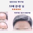 서정리가발
