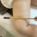 이레스텐레스 | 분당피부관리 하체관리 잘하는 20년 경력의 이레바디스킨 후기