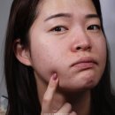 ㈜하니케어 | 올리브영 미백세럼 추천템 아비브 차은우 세럼으로 잡티케어