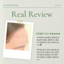 김지은피부과의원 | 신용산역 피부과 입술 필러 어떻게 선택할까요?