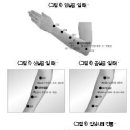 "정신요법 '염파' 서암뜸과 병행 효과 배가" 이미지