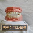 비앤이치과의원 네이버블로그