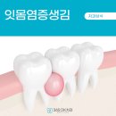 방배동치과 이수역치과 어울림치과의원 잇몸염증 치료 후기