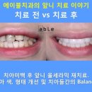 에이블치과기공소 이미지