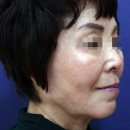 리뉴미피부과의원 이미지