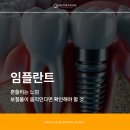 이룩치과의원 | 고덕동치과 임플란트 흔들리는 느낌 보철물이 움직인다면 확인해야 할 것