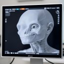 힐메디의원 | 이게 왜 이렇게 핫한지 드디어 알았다!