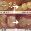 세라치과기공소 이미지