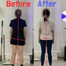 보인한의원 | 바디컨설팅에서 한의원·정형외과에서도 안 되던 두통, 자세가 바뀌자 달라졌어요