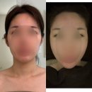 다오 에스테틱 | 수원 윤곽관리 추천, 아윤에스테틱 작은얼굴윤곽리프팅 관리 재재재방문 후기