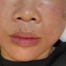 에그뮤즈 스킨스칼프 이미지