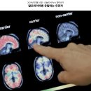 ***_******_APOE4, a key factor for Alzheimer's 이미지