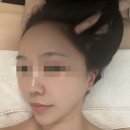 티움 카페&갤러리 | [부산여드름관리] 해운대여드름관리 전문 ‘헤스티움 센텀점’ | 여드름피부 압출+진정 후기