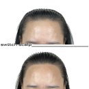 스위치스칼프