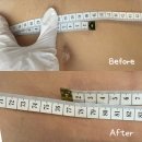 세류3 829-34 | 솔직후기 쉽고 편한 체질개선 다이어트 수원 다이어트 [셀포랩이음] 세류동 다이어트