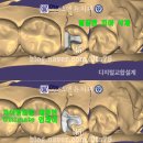 윤치과기공소 이미지