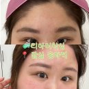 아리헤어라인 | 송파 잠실 왁싱샵 추천 헤어라인 + 이마 + 눈썹 후기 “리아이왁싱”