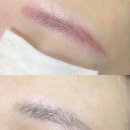 윤브로 | 💫 [잔흔제거 수강모집] 실무중심 관리 원데이클래스 오픈!
