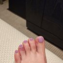 한두골천 | 해외여행 중 발가락 실금/골절, 보험 보상, 노깁스 예스테이핑, 골절진단금 보험 회복한 후기