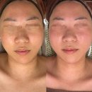 웰빙메디컬빌딩 | 탄력, 이걸 놓치면 후회할지도 몰라요