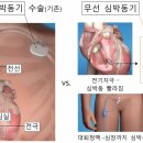 어지럽고 숨찬 ‘서맥성 부정맥’ 노인, 수술 걱정 &#39;끝&#39; 이미지