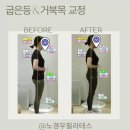 거북목 교정 후기#노경우필라테스#광장동필라테스#구의동필라테스#광진구필라테스