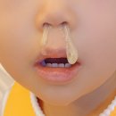 이진우이비인후과의원 네이버블로그