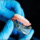메디컬뱅크치과의원 네이버블로그