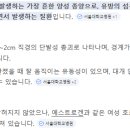 시험관 진행중인 30대의 유방x-ray, 유방초음파, 유방조직검사 후기 (feat. 작은가슴)