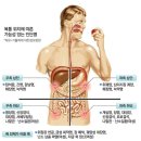 [건강운동-] 이유없는 복통 없다..위치 따라 원인질병 30가지 이미지