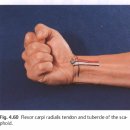 손목, 손가락 관절의 질환과 촉진에 대하여 이미지