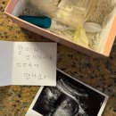 백수진 | 호산병원 백수진 원장님 임신 8주차 계류유산 소파술 후기 (회복과 재임신)