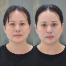 경기도 수원시 권선구 경수대로381번길 18 (권선동) | 권선동 윤곽관리 아미아 에스테틱 수원 이마트점, 작은얼굴 경락 안면유지인대 관리 전후 후기