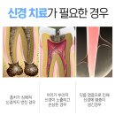 성신치과의원 | 성신여대입구역 치과 치아가 아플 때 이해해야 할 것들