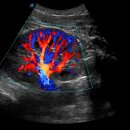 엔도소노 이미지