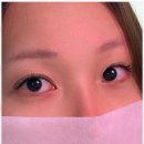아미브로우