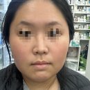 메디팜건강약국 | [사진O/솔빛스킨/솔브] 열감피부•트러블피부• 화농성피부 강력추천 !