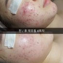 아리따운피부 이미지