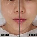 블랑미토탈뷰티 네이버블로그