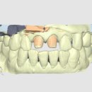 스마일기공소 이미지