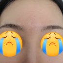 씨유 의정부운동장점 | [서울 의정부] 의정부 피부과 리쥬란 후기 피부결, 광 확실히 달라진 의정부역피부과 솔직 후기