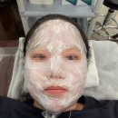 광덕안정 | [강남] 내돈내산, 편평사마귀 무제한 제거 후기(광덕안정한방병원)_약혐주의