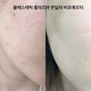 엔젤율 | [마산 에스테틱] :: n년째 다니고 있는 내돈내산 찐 추천하고싶은, 율 에스테틱(⭐️피부고민이신 분들...