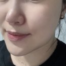 고운 프리티 | 프레티 히알루로닉 클리어 필링젤 솔직후기 (저자극 필링젤 추천)