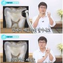 치실 안쓰면 생기는 충치 종류. 이미지