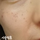 미앤영