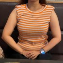 (주)신차이 | 팔뚝지방흡입 후관리 효과 후기 및 3개월차 전후차이 비교