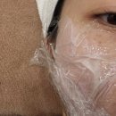 안산우리약국 | [💎안산 피부관리 : 세르뷰티💎] 화장으로도 안가려지던 주근깨 제거 &amp; 관리 | 색소화이트닝 관리법🧴