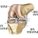 십자인대파열 동요장해의 자동차보험과 장기보험 비교 이미지